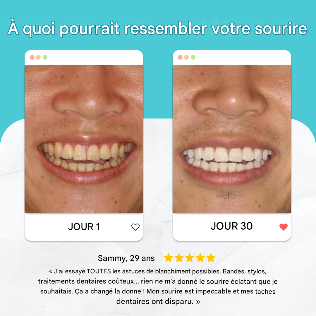 Vivbeau QIAWI electric automatic toothbrush