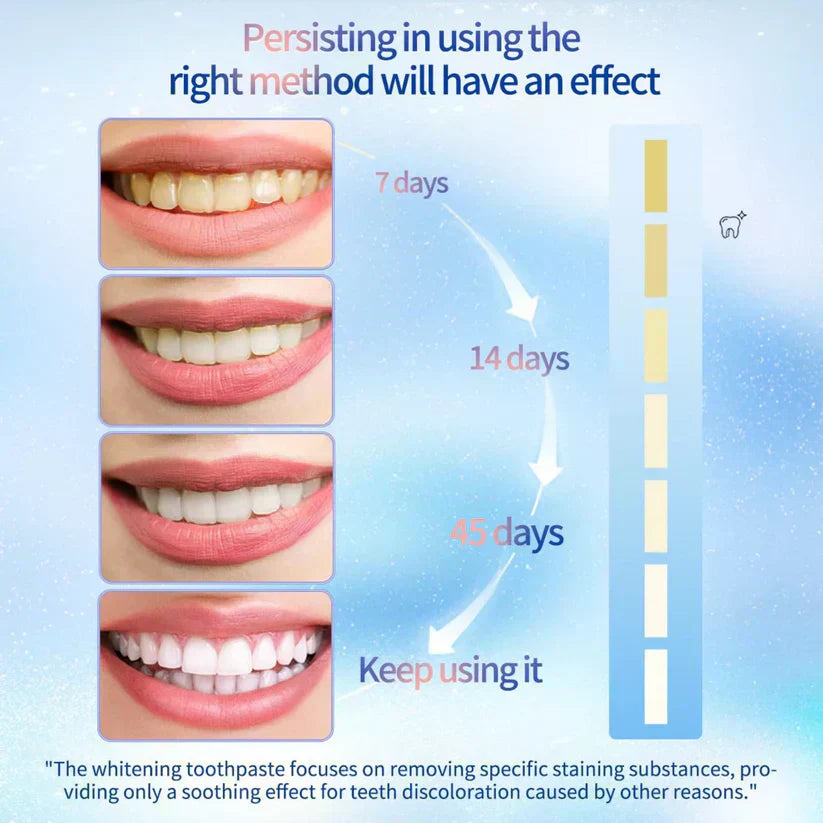 Vivbeau LOVILDS™ Niacinamide Whitening Toothpaste